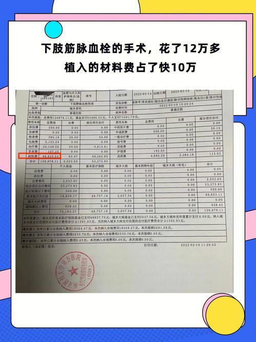 动脉瘤手术十多万能报销多少？看完这篇文章就知道了