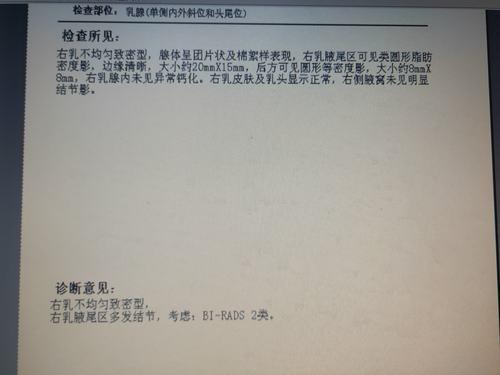 乳腺钼靶检查多少钱？影响价格的因素有哪些？