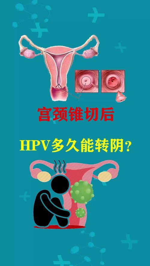宫颈锥切手术费用多少钱？